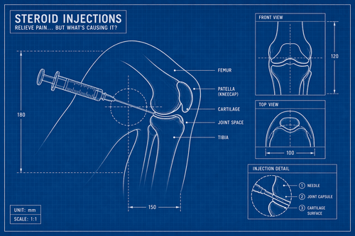 Side Effects, and Safer Long-Term Alternatives for Joint Pain Relief