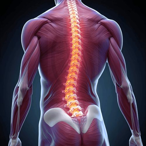 Gravity Is The Greatest Enemy for Scoliosis